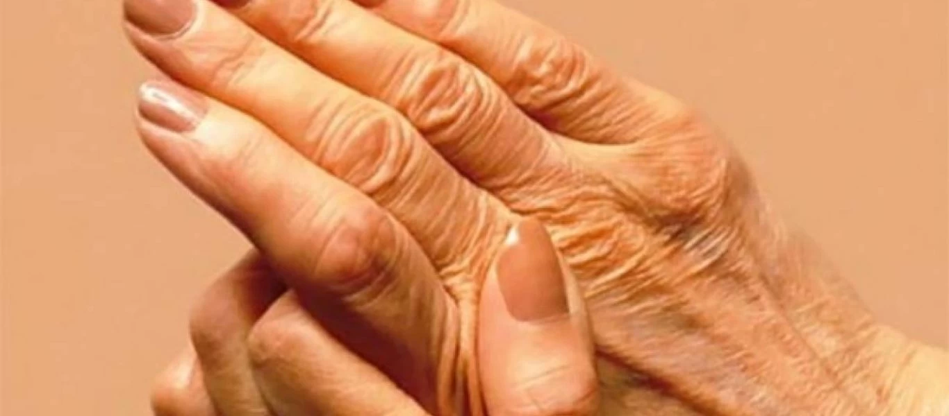 Αρθρίτιδα: Συμπτώματα και τι να φάτε για να ανακουφιστείτε